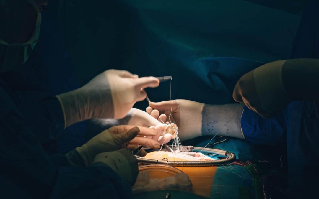 Minimally Invasive Cardiac Surgery vs. Traditional Surgery Pros and Cons